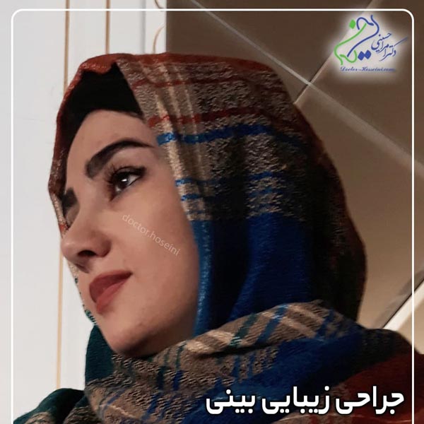 جراحی زیبایی بینی -دکتر امرالله حسینی