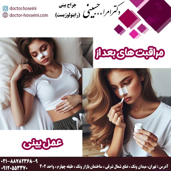 مراقبت های بعد از عمل بینی - دکتر امرالله حسینی - doctor-hosseini.com