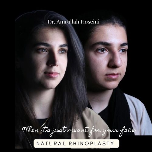 rhinoplasty-709
