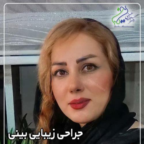 جراحی-بینی-404