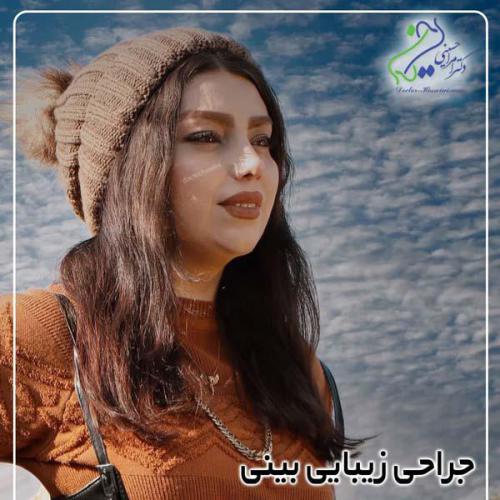 جراحی-بینی-411