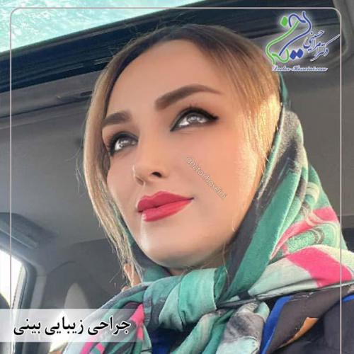 جراحی-بینی-422