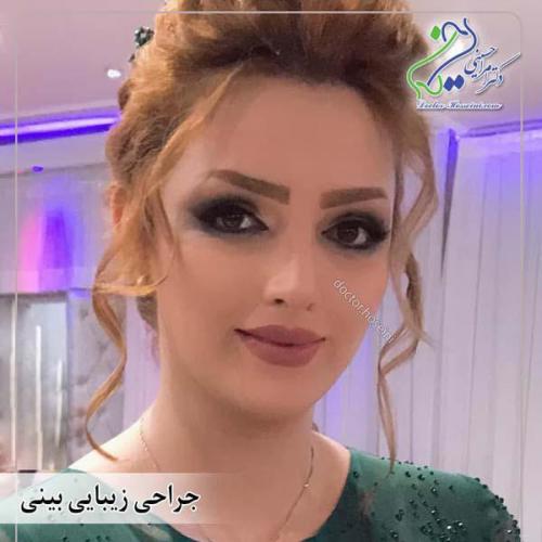 جراحی-بینی-423