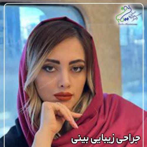 جراحی-بینی-429