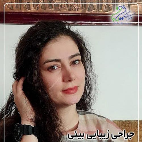 جراحی-بینی-432