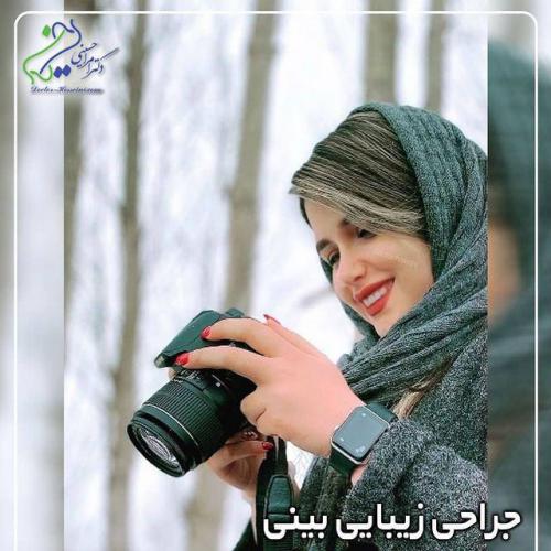 جراحی-بینی-479