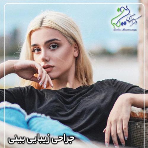 جراحی-بینی360