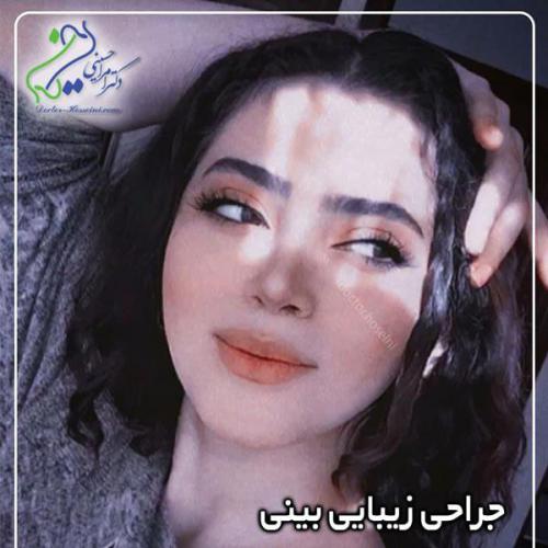 جراحی-بینی361