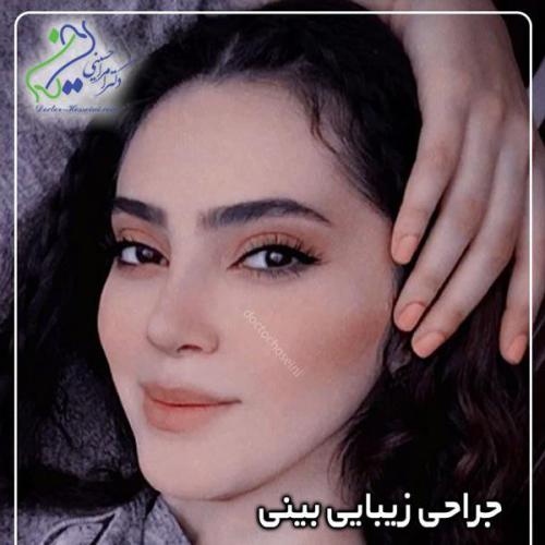 جراحی-بینی362