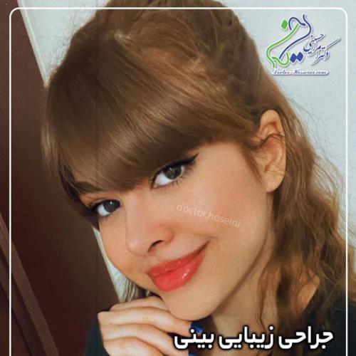 جراحی-بینی366