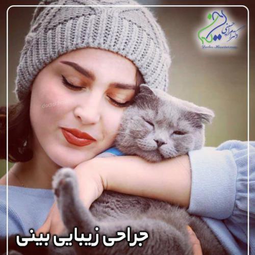 جراحی-بینی370