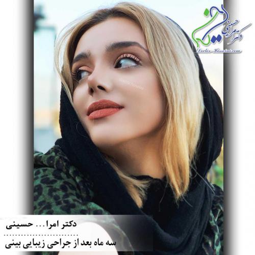 جراحی بینی 329