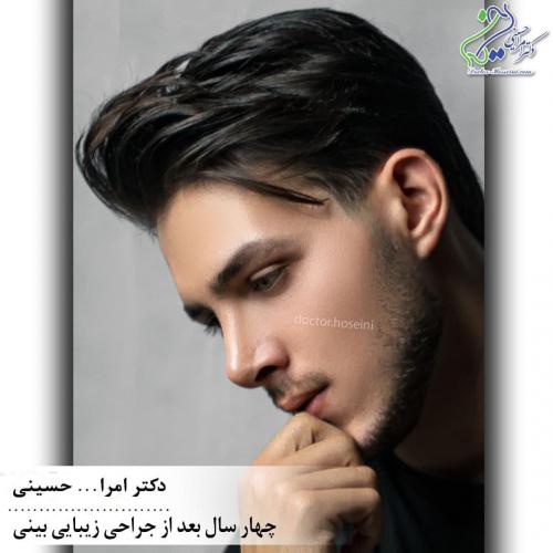 جراحی بینی 352