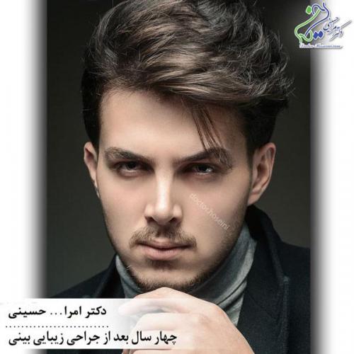 جراحی بینی 353