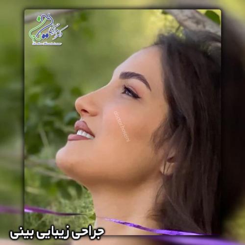 جراحی بینی 357