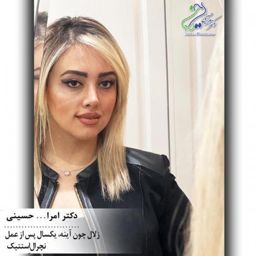 جراحی-بینی-550 (1) (1)