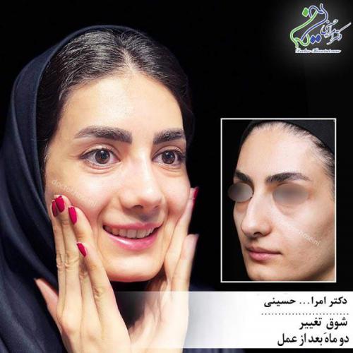 جراحی-بینی-551 (1) (1)